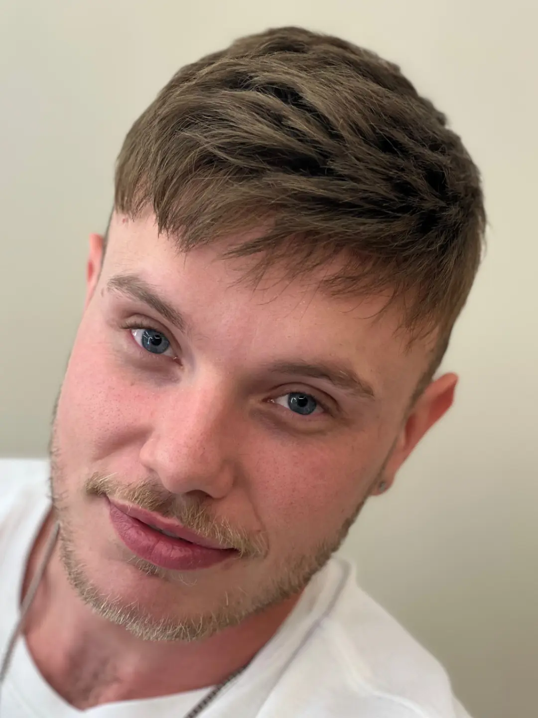 Cliente depois da aplicação, com corte curto e linha frontal natural